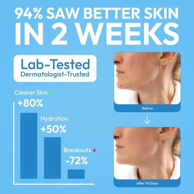 Alt view image 5 of 5 - Cleansing Facial Towel 50 Count - Disposable Face Towelette XL - Biodegradable, Ultra-soft, Plant Based & Tear-Resistant Face Cloths - Towels for Makeup Remover & Reduce Acne for Clearer Skin