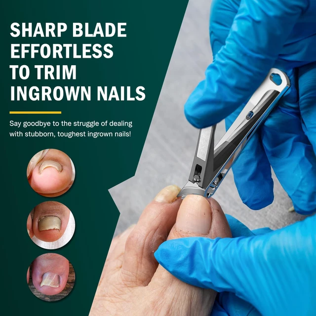 Alt view image 2 of 7 - Slanted Edge Nail Clippers - Angled Curved Blade Ingrown Nail Clipper for Thick Toenails, Podiatrist Toenail Clippers for Men and Women (Black)