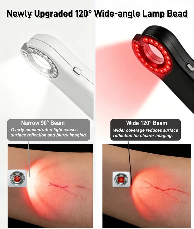 Alt view image 4 of 5 - Portable Vein Finder for IV Access (Black) Hand Held Vein Locator Device Type-C Charging Suitable for All Skin Tones, Nurses, Doctors and Home Use