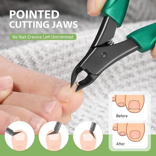 Alt view image 2 of 7 - Straight Toenail Clippers for Thick Nails & Ingrown Toenails
