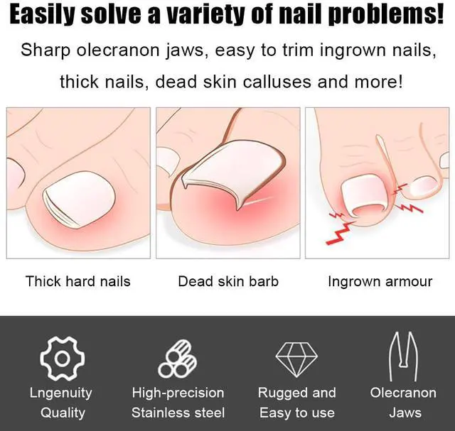 Alt view image 3 of 6 - Toenail Clippers for Thick Toenails,Heavy Duty Ingrown Toenail Clipper for Ingrown Toenail Removal Correction Clippers,Professional Pedicure Tool