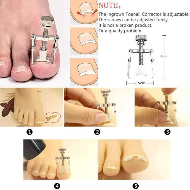 Alt view image 2 of 6 - Toenail Clippers 12-Piece Nail Treatment Foot Tool, Ingrown Toenail Removal Correction Clippers, Surgery Grade Nail File Lifter, Professional Pedicure Tool.
