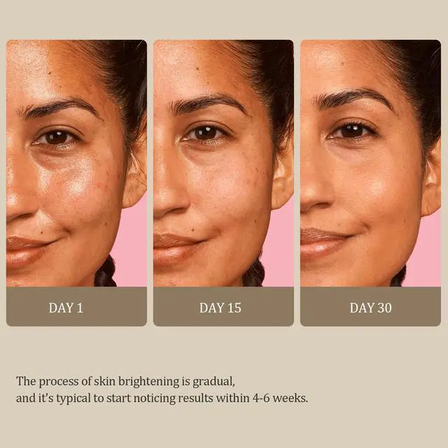 Alt view image 6 of 7 - Kojic Acid Soap Dark Spot Remover, Honey Glow Turmeric Soap for Hyperpigmentation, with Kojic Acid, Turmeric, Shea Butter, Coconut Oil, Vitamin C, Skin Brightening for Face & Body, 3 Bars