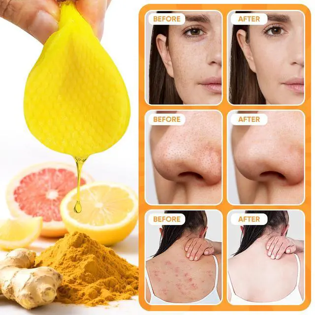 Alt view image 2 of 7 - Turmeric Face Pads 50 Pcs, Turmeric Soap & Turmeric Face Wash with Brush
