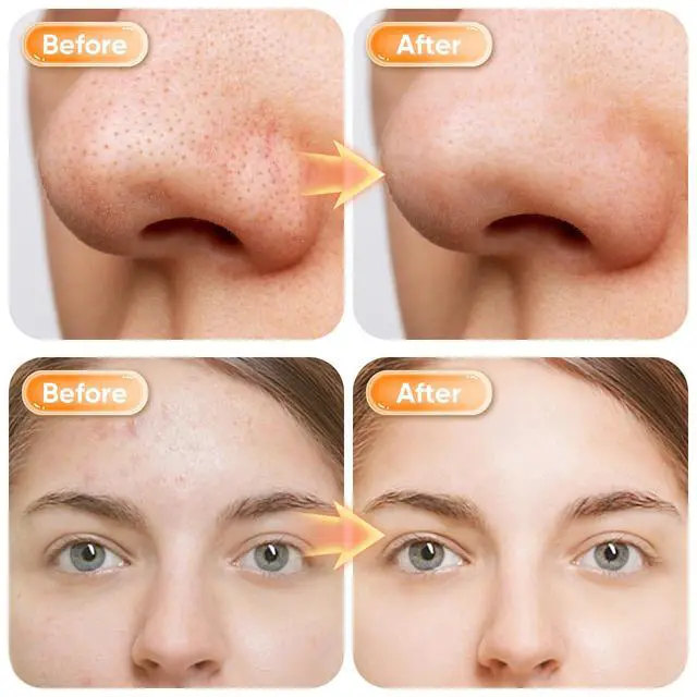 Alt view image 6 of 7 - 2pcs Turmeric Face Wash Set, Turmeric Foaming Facial Cleanser for All Skin