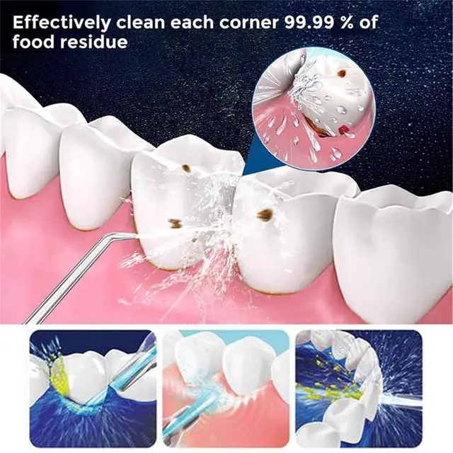 Alt view image 4 of 7 - Portable Oral Irrigator Water Flosser Dental Water Toothbrush Toothpick Nasal Irrigator Implement Teeth Cleaner Oral Hygiene flossers for Home Travel with 5pcs Nozzles (Nozzle and Tongue Scraper)