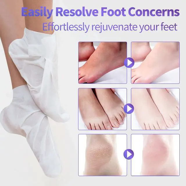 Alt view image 4 of 7 - 5 Pack Moisturizing Foot Mask, Hydrating Feet Mask for Dry Cracked Feet, Moisturizing Foot Socks Dry Skin Moisturizer for Soft Smooth Feet, Foot Spa Care Kit, Ideal Holiday Gift for Women and Men