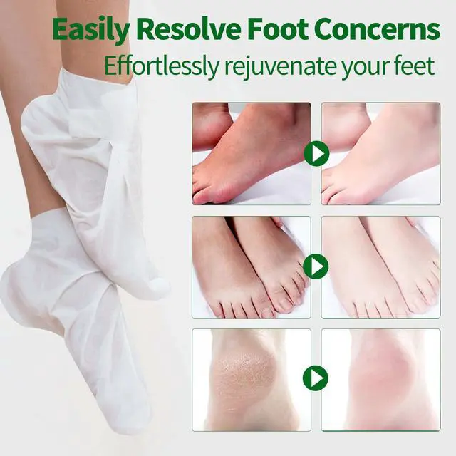 Alt view image 4 of 7 - 5 Pack Moisturizing Foot Mask, Hydrating Feet Mask for Dry Cracked Feet, Moisturizing Foot Socks Dry Skin Moisturizer for Soft Smooth Feet, Foot Spa Care Kit, Ideal Holiday Gift for Women and Men