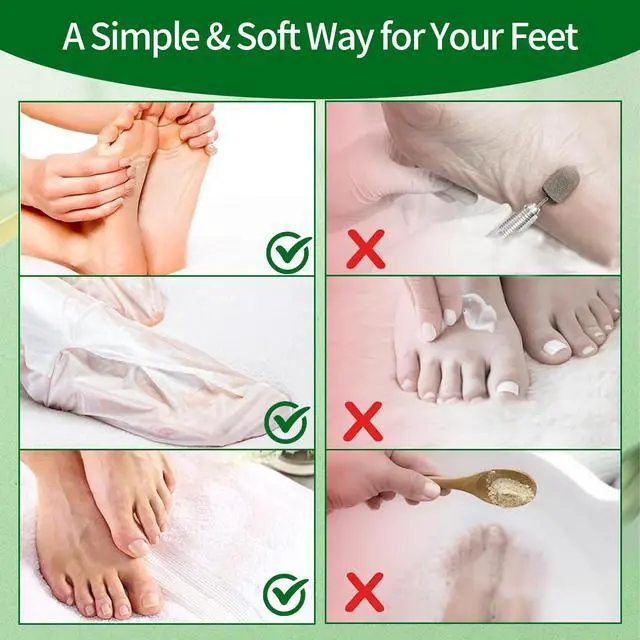 Alt view image 6 of 7 - 5 Pack Moisturizing Foot Mask, Hydrating Feet Mask for Dry Cracked Feet, Moisturizing Foot Socks Dry Skin Moisturizer for Soft Smooth Feet, Foot Spa Care Kit, Ideal Holiday Gift for Women and Men