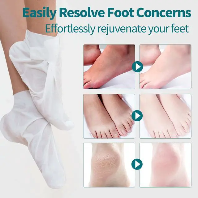 Alt view image 4 of 7 - 5 Pack Moisturizing Foot Mask, Hydrating Feet Mask for Dry Cracked Feet, Moisturizing Foot Socks Dry Skin Moisturizer for Soft Smooth Feet, Foot Spa Care Kit, Ideal Holiday Gift for Women and Men