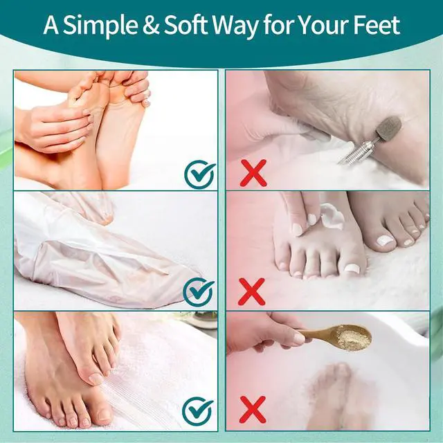 Alt view image 6 of 7 - 5 Pack Moisturizing Foot Mask, Hydrating Feet Mask for Dry Cracked Feet, Moisturizing Foot Socks Dry Skin Moisturizer for Soft Smooth Feet, Foot Spa Care Kit, Ideal Holiday Gift for Women and Men