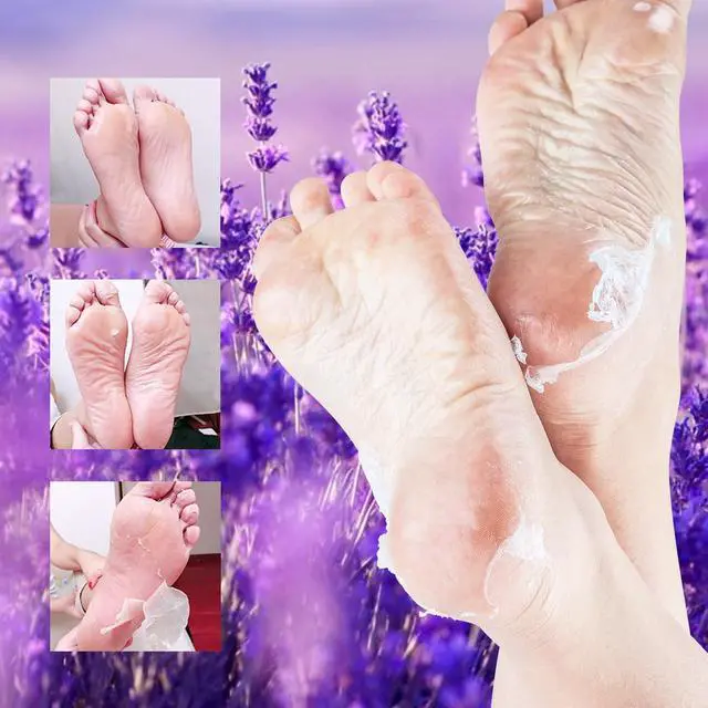 Alt view image 4 of 7 - Foot Peeling Mask - 5 Pack Exfoliating Foot Peel Mask for Dry Cracked Feet - Baby Soft Foot Mask Socks for Removing Dead Skin, Cracked Heels, and Calluses - Lavender, Shea Butter, Aloe - Women and Men