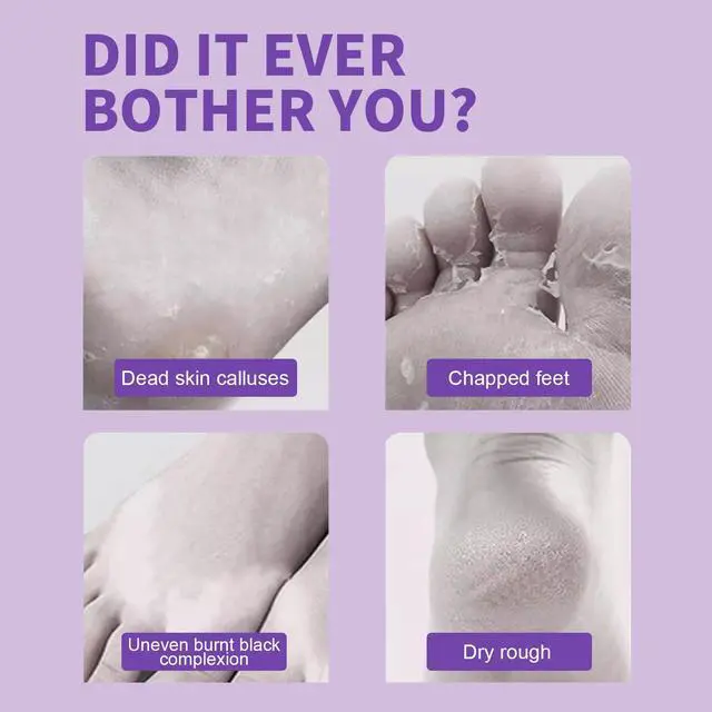 Alt view image 6 of 7 - Foot Peeling Mask - 5 Pack Exfoliating Foot Peel Mask for Dry Cracked Feet - Baby Soft Foot Mask Socks for Removing Dead Skin, Cracked Heels, and Calluses - Lavender, Shea Butter, Aloe - Women and Men