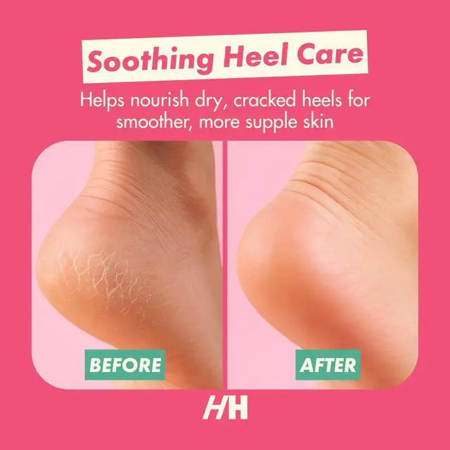 Alt view image 3 of 7 - Overnight Heel Repair Socks, Foot Mask for Cracked Heel 2pc