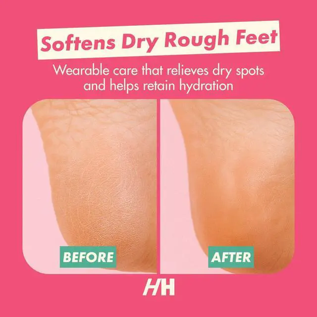 Alt view image 7 of 7 - Overnight Heel Repair Socks, Foot Mask for Cracked Heel 2pc