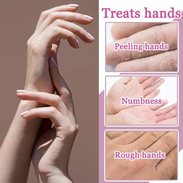 Alt view image 3 of 7 - Hydrating Hand Masks, 6PCS Hand Mask Moisturizing Gloves for Men Women, Smooth Long Lasting Soft Exfoliating Hand Peeling Spa Mask Moisturizer Beauty Gift Set for Dry Cracked Rough Dull HandsA)