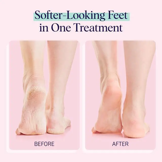 Alt view image 4 of 7 - Moisturizing Foot Sockies | Foot Mask for Dry Cracked Feet | Tea Tree Oil Softening Booties | Callus Remover Alternative | Self Care Gifts for Women | 4 Pack