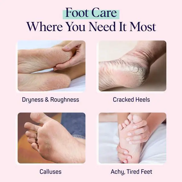 Alt view image 7 of 7 - Moisturizing Foot Sockies | Foot Mask for Dry Cracked Feet | Tea Tree Oil Softening Booties | Callus Remover Alternative | Self Care Gifts for Women | 4 Pack