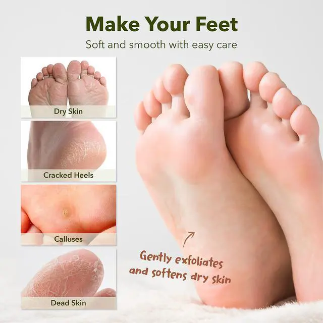 Alt view image 7 of 7 - Foot Peeling Mask for Dry Cracked Feet, Exfoliating Treatment for Dead Skin & Calluses for Baby Soft Feet, 3 Pairs