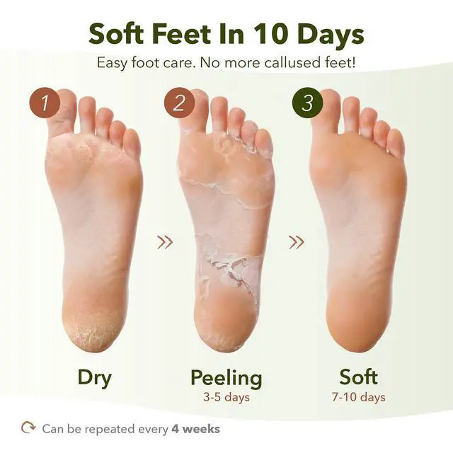 Alt view image 3 of 7 - Foot Peeling Mask for Dry Cracked Feet, Exfoliating Treatment for Dead Skin & Calluses for Baby Soft Feet, 3 Pairs