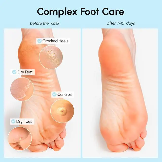 Alt view image 3 of 7 - Foot Peeling Mask 3-in-1 Foot Mask for Dry Cracked Feet, Callus Remover Dead Skin Exfoliating Foot Peel Mask with Glycolic Acid Moisturizing Socks for Men Spa Self Care Gifts for Women