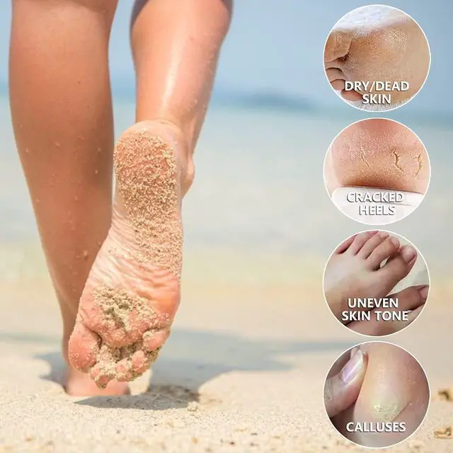 Alt view image 5 of 7 - 5 Pack Foot Peeling Mask,Exfoliator Peel Off Calluses Dead Skin Callus Remover,Foot Mask for Dry Cracked Feet,Foot Peel Masks for Men and Women,Feet Peeling Mask,Spa Gifts for Women,Self Care Gifts