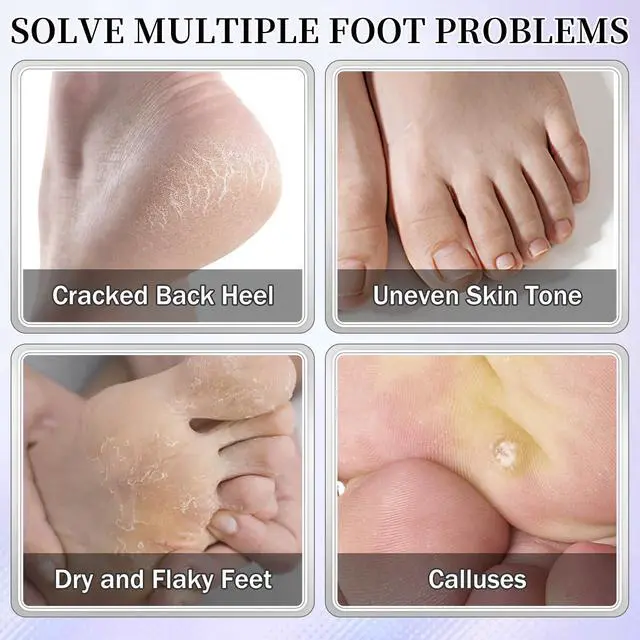 Alt view image 3 of 7 - 10PCS Moisturizing Foot Mask Set for Dry Cracked Feet, Foot Care Kit