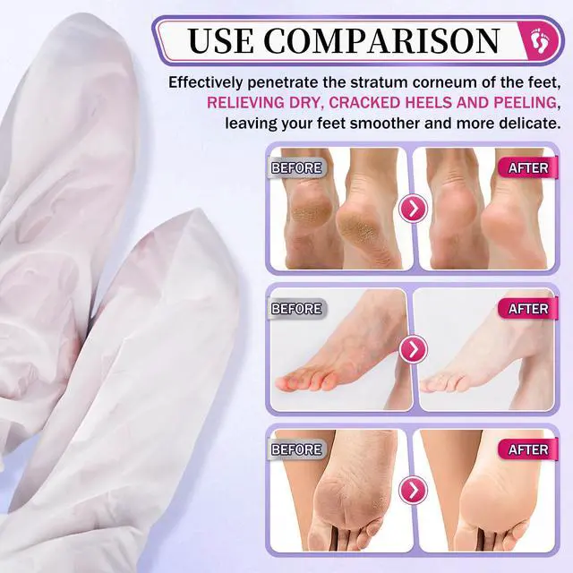 Alt view image 4 of 7 - 10PCS Moisturizing Foot Mask Set for Dry Cracked Feet, Foot Care Kit