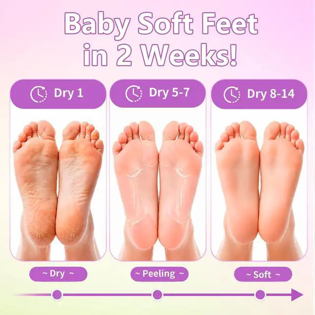 Alt view image 3 of 7 - 6 Pack Foot Peeling Mask, Foot Mask for Exfoliates Dead Skin & Tough Calluses, Softens Dry Cracked Rough Heels to Restore Baby Soft Feet, Feet Peeling Mask Gift for Men Women, Birthday & Anniversary