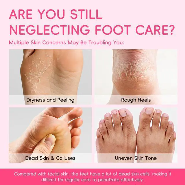 Alt view image 3 of 6 - Japan Sakura Moisturizing Foot Mask, Foot Mask for Dry Cracked Feet