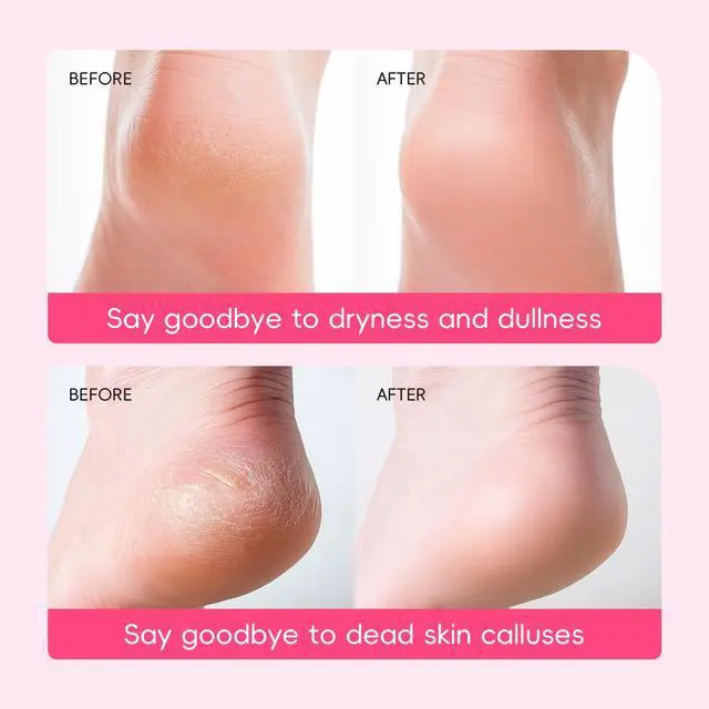 Alt view image 5 of 6 - Japan Sakura Moisturizing Foot Mask, Foot Mask for Dry Cracked Feet
