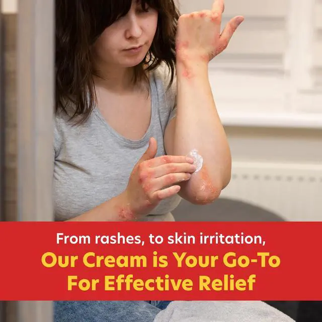 Alt view image 6 of 7 - Maximum Strength Anti-Itch Cream (4 oz.), with Calming Aloe Vera, 1% Hydrocortisone Itch Relief for Eczema, Psoriasis, Bug Bites, Poison Ivy, Oak and Sumac, 2 oz. Tube (Pack of 2)