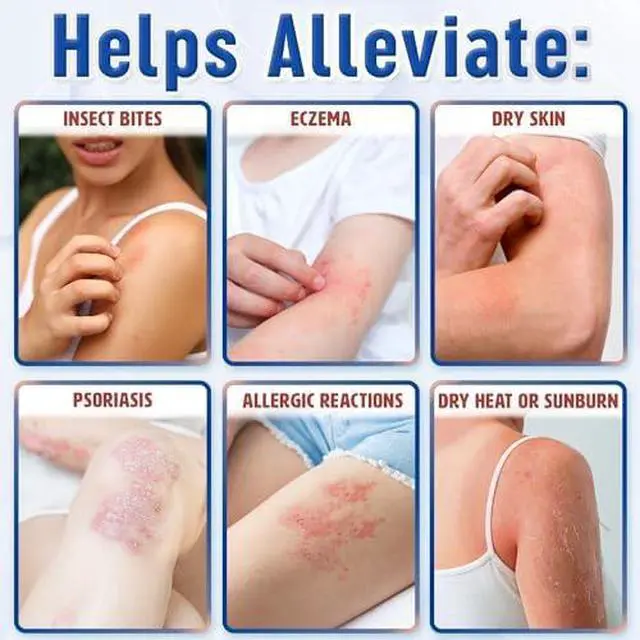 Alt view image 3 of 7 - Calming Relief Cream - 8.5 oz / 250 ml - Moisturizing Comfort from Itchy Skin, Helps Alleviate Itch from Eczema, Hives, Sunburn - Vegan Formula with Shea Butter & Tea Tree Oil