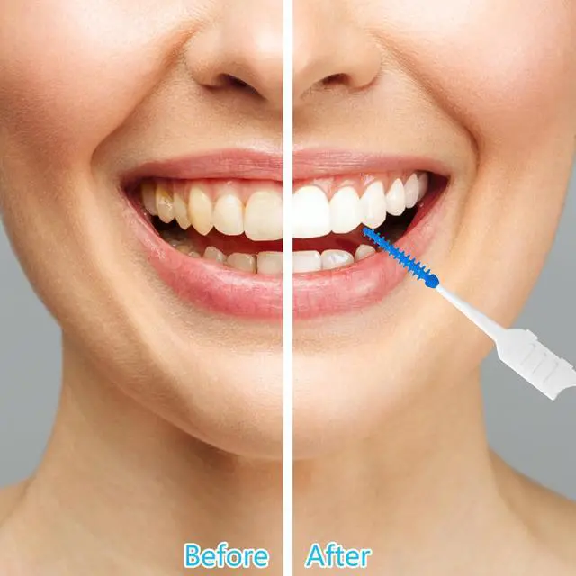 Alt view image 3 of 4 - 250 Dental Floss Picks, Silicone Interdental Brushes, Blue | Soft Silicone Tip, 2-In-1 Brush And Pick, Portable Case, For Tight Spaces And Daily Teeth Cleaning
