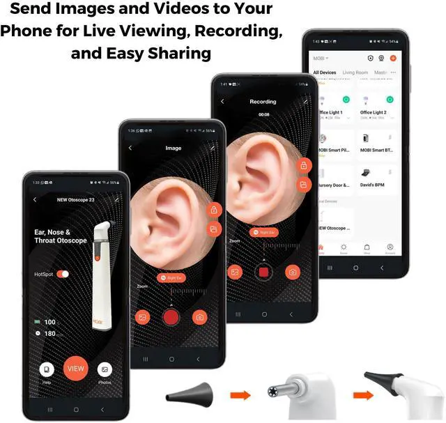 Alt view image 4 of 7 - MOBI Smart Otoscope Jr. Ears, Nose and Throat Camera, Suitable for Children and Baby, Multi-Axis Gyroscope, Smart App ENT Otoscope