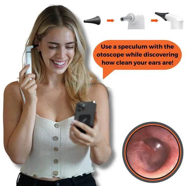 Alt view image 2 of 3 - MOBI 20-Piece Speculum Set for Use with MOBI Otoscope - Professional Grade Accessories for Ear, Nose, and Throat Examination, Black
