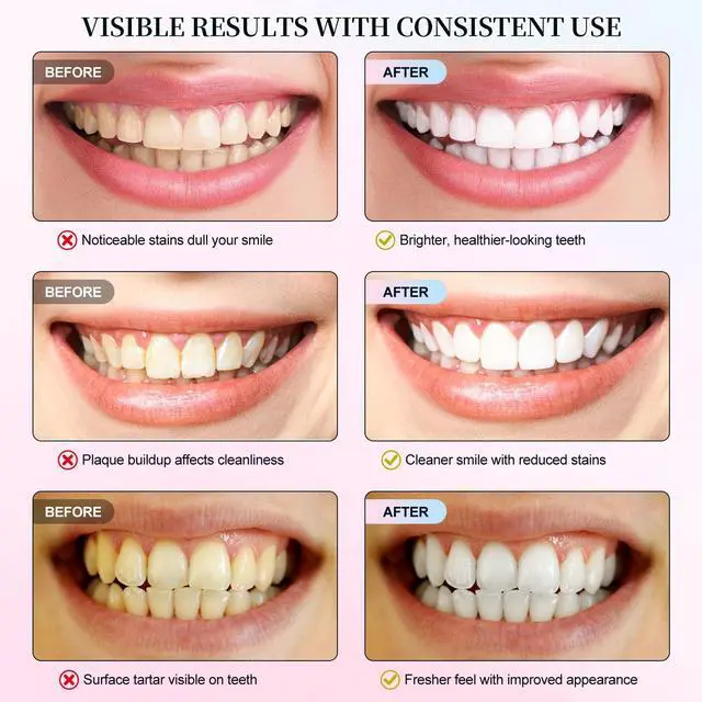 Alt view image 6 of 7 - Niacinamide Whitening Toothpaste, Intensive Whitens Teeth, Protects Tooth Enamel Natural Gentle Care, Freshens Breath, Fluoride-Free Formula is Suitable for Sensitive Teeth - 3.8 oz | 1 Pcs