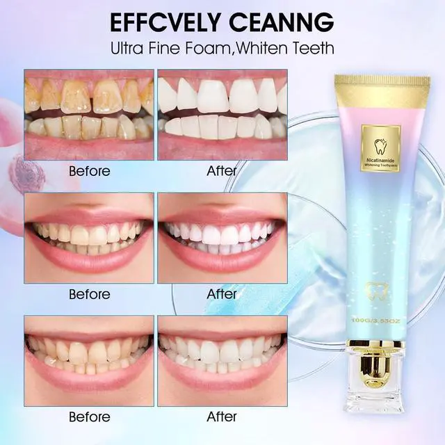 Alt view image 4 of 5 - 2PCS Niacinamide Whitening Toothpaste,Niacinamid Toothpast,Niacinamide Intensive Whitening Toothpaste, Fresh Breath, Remove Tooth Stains,Complete Care
