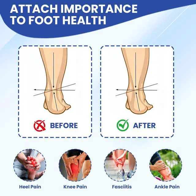 Alt view image 6 of 7 - Shoe Inserts for Women & Men Arch Support Orthotics Insoles for Plantar Fasciitis, Flat Feet, Pronation and Heel Pain(Men 7-7.5|Women 9-9.5)