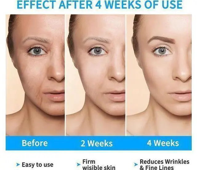 Alt view image 9 of 12 - Face Lift, Electric V Face Shaping Massager, V Face Beauty Device