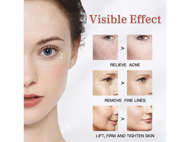 Alt view image 13 of 14 - Face Massager for Face Lift, Facial Roller Device, Multifunctional Skin Care Tools