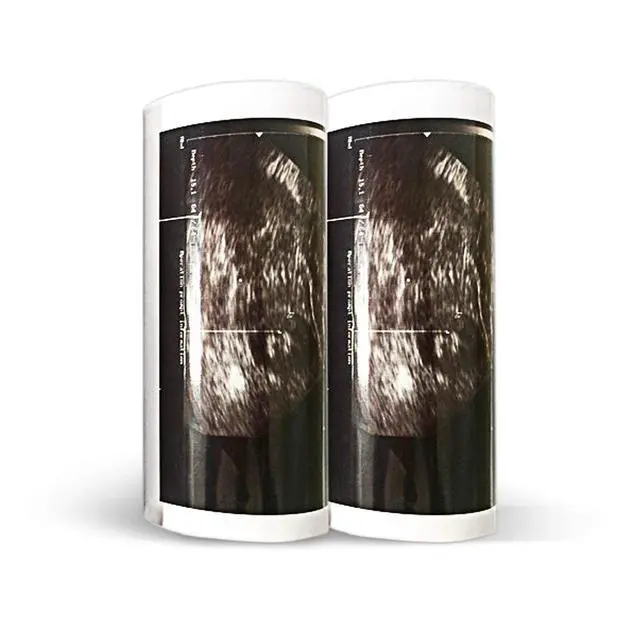 Alt view image 2 of 2 - Black & White Thermal Paper, Standard Density, 10 rolls/bx
