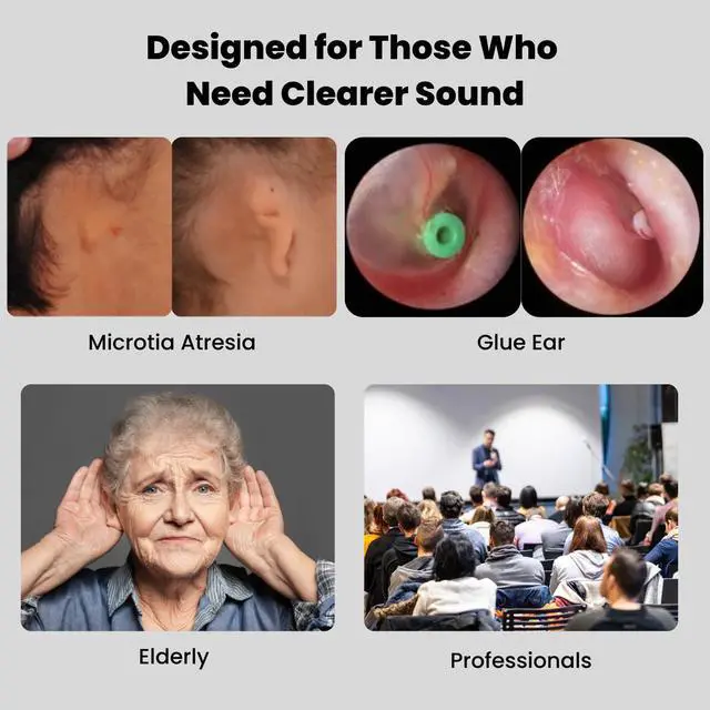 Alt view image 3 of 7 - HearLink 3-in-1 Hearing Enhancement Device - Pocket Talker, Long-Range Listening Device - Wireless Remote Microphone & Audio Transmitter - Cost-Effective Alternative to BAHA for HOH