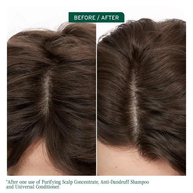 Alt view image 2 of 7 - Scalp Sync Anti-Dandruff Shampoo Controls Dandruff, 1.7 fl oz