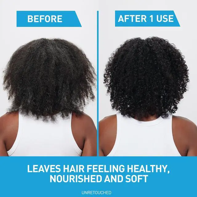 Alt view image 4 of 7 - 2 In 1 Hydrating Anti Dandruff Shampoo And Conditioner, 12 Fl Oz