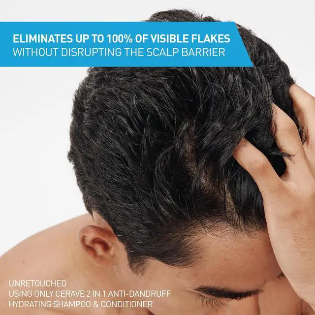 Alt view image 2 of 7 - 2 In 1 Hydrating Anti Dandruff Shampoo And Conditioner, 12 Fl Oz