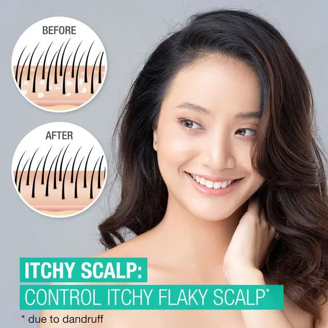 Alt view image 3 of 7 - Scalp Therapy Anti-Dandruff Shampoo for Itchy Scalp, 2.5% salicylic acid with Peppermint Fragrance, 12 fl oz