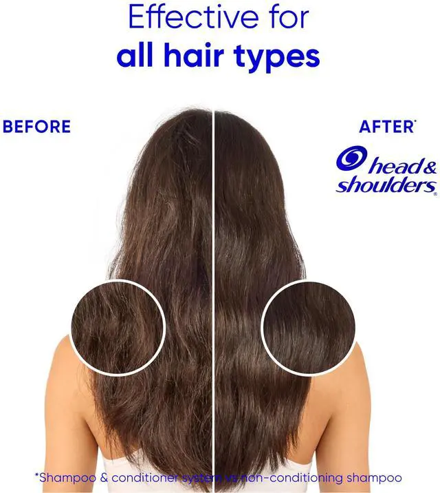 Alt view image 6 of 7 - Anti-Dandruff Shampoo and Conditioner for Women | Smooth & Silky 2-in-1 | 1% Pyrithione Zinc, 24-Hour Frizz Control, Soothes Dry & Itchy Scalp, Healthy, Shiny & Smooth, 28.2 Fl Oz