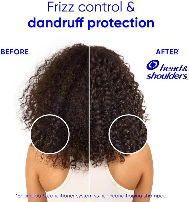 Alt view image 5 of 7 - Anti-Dandruff Shampoo and Conditioner for Women | Smooth & Silky 2-in-1 | 1% Pyrithione Zinc, 24-Hour Frizz Control, Soothes Dry & Itchy Scalp, Healthy, Shiny & Smooth, 28.2 Fl Oz