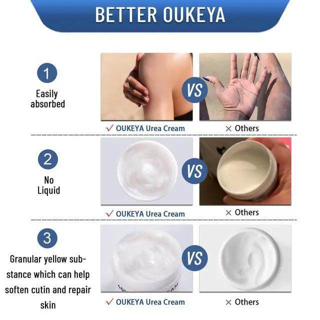 Alt view image 3 of 7 - 40 Percent Urea Cream Hand Foot Cream for Dry Cracked Skin